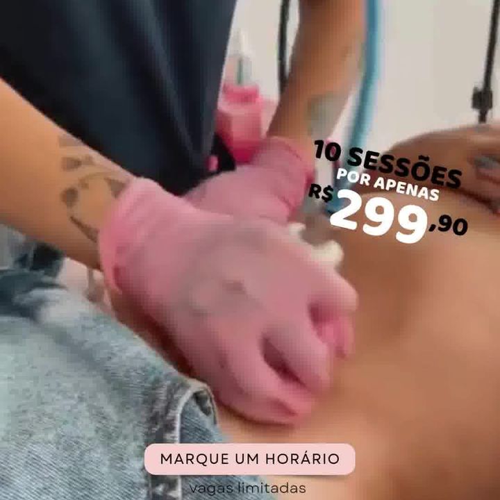 Anúncio da Oceane: 10 sessões de endermoterapia por R$ 299,90