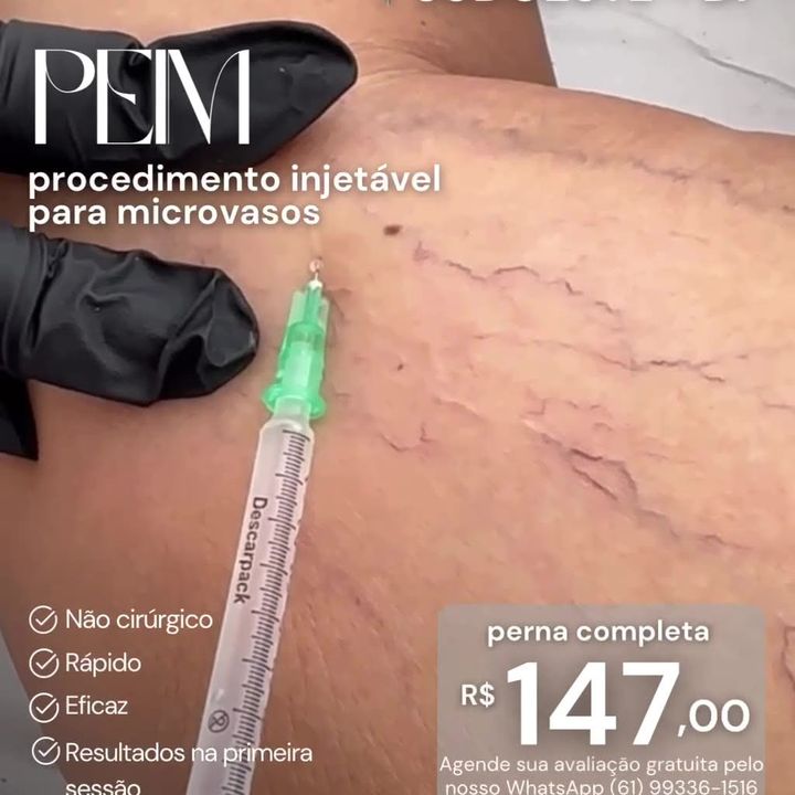Anúncio da Pelíssima: PEIM, procedimento injetável para microvasos, perna completa por R$ 147